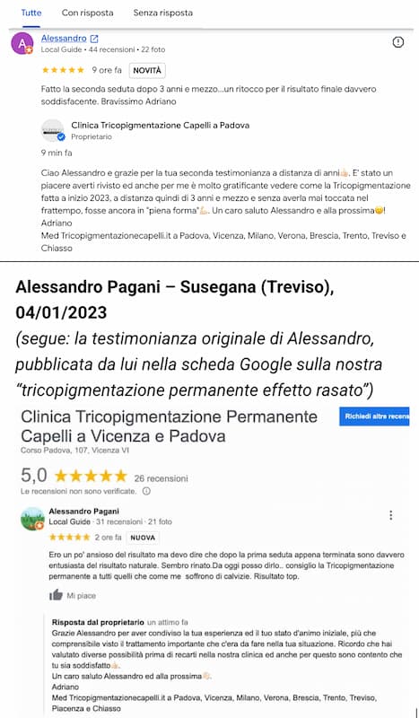 Tricopigmentazione-permanente-effetto-rasato-uomo-prima-dopo-opinioni-treviso-padova-verona-vicenza-venezia-trento-brescia-milano-belluno-bolzano-lugano-alessandro-pagani-susegana-2